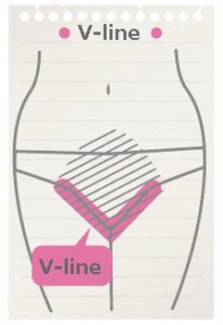 what's V-line
