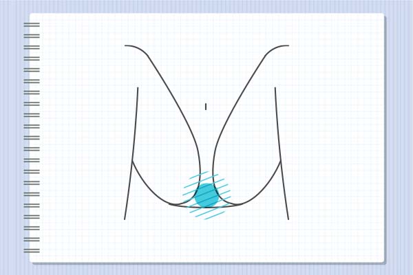 VIOとは?V I Oどこ?VIOの場所や意味を教えて!VIOのOとは 女性 2026年版、女のOラインの場所(イラスト図)
